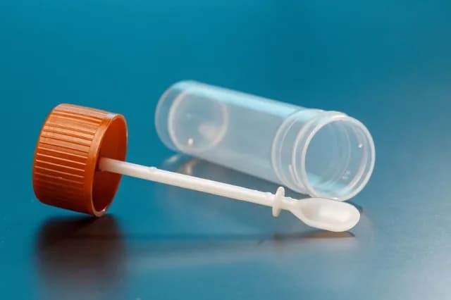 Kalprotektyna: Co oznacza jej podwyższony poziom w kale?