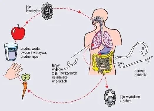 Pasożyty w ciele: 7 alarmujących objawów i co robić?