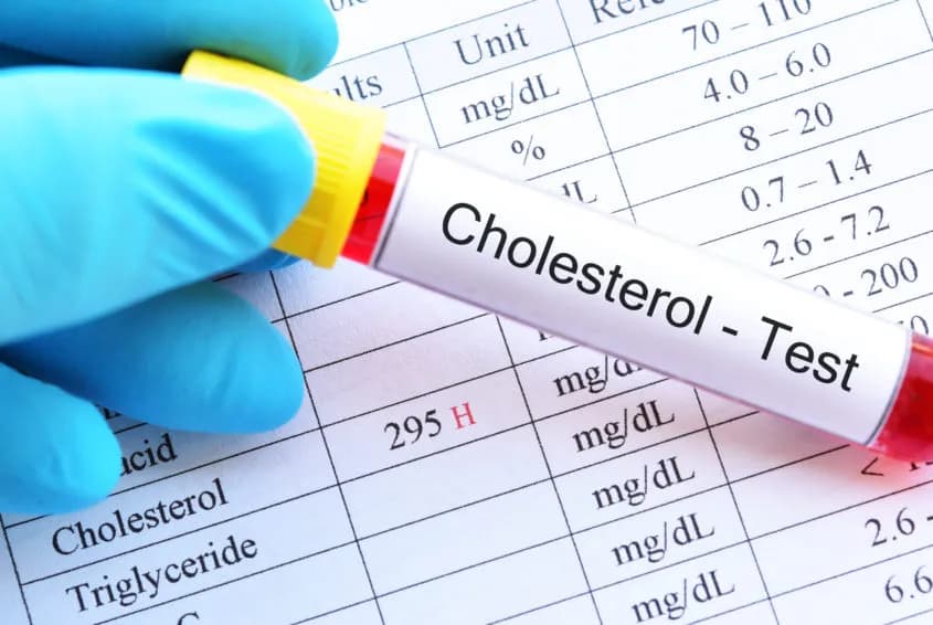 Jak stres podnosi cholesterol i co możesz z tym zrobić dla zdrowia