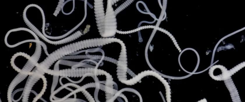 Tasiemiec psi u człowieka: 5 objawów których nie przegap